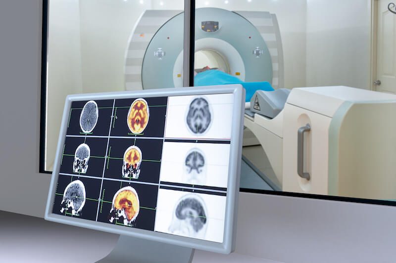 What Resonance Imaging (MRI)? | Independent Imaging